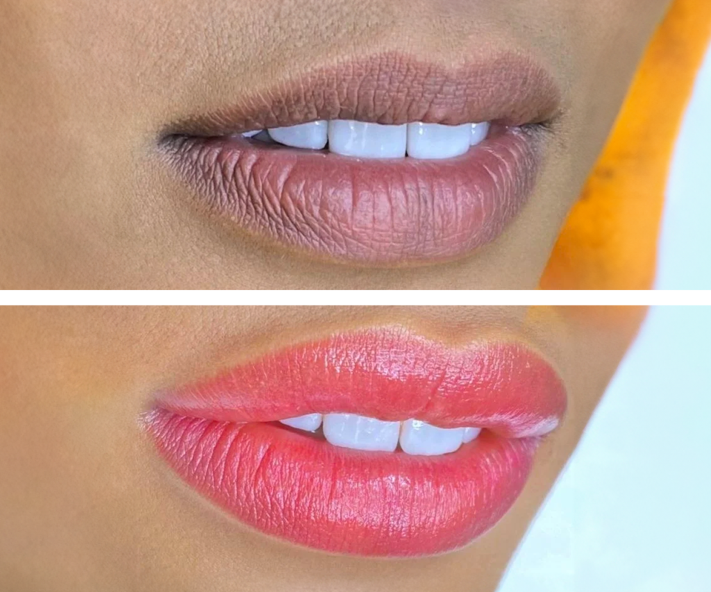 DARK LIP CORRECTION – ESTETICO